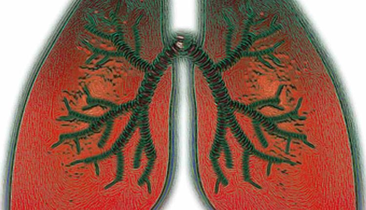How Will You Prevent Asthma