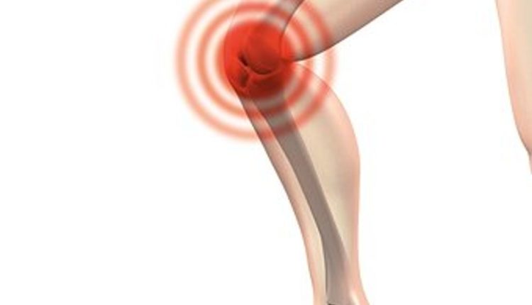 Knee Replacement Surgery Facts