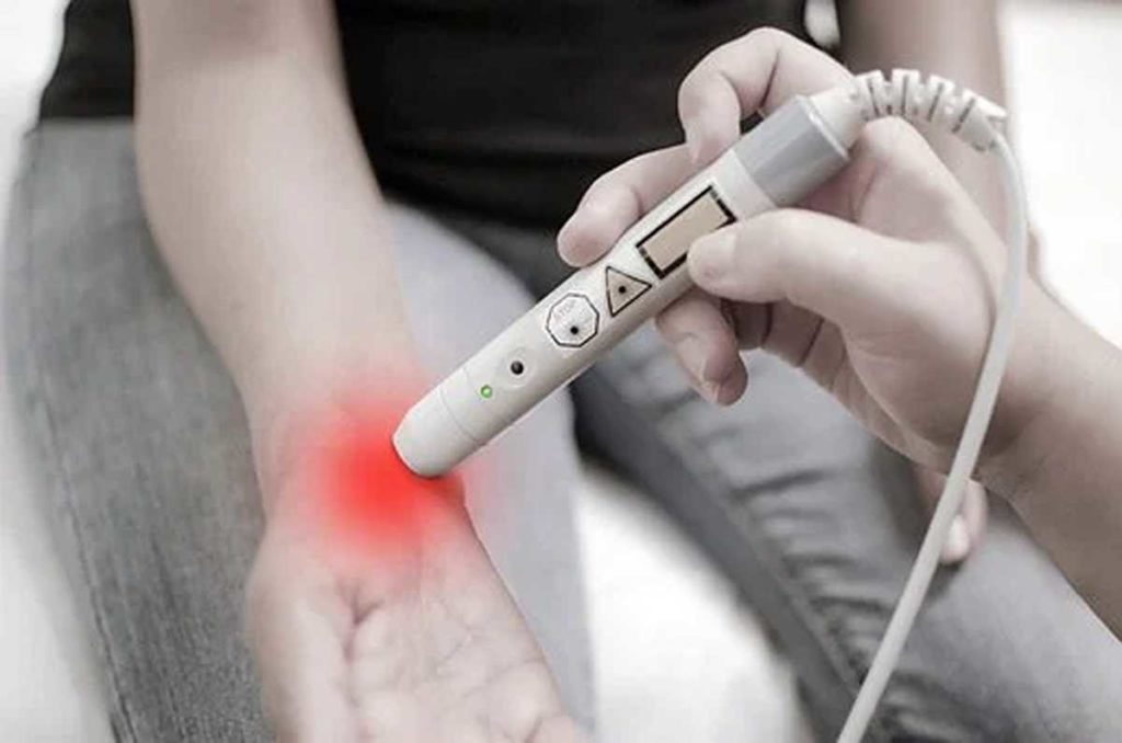 Piriformis Syndrome